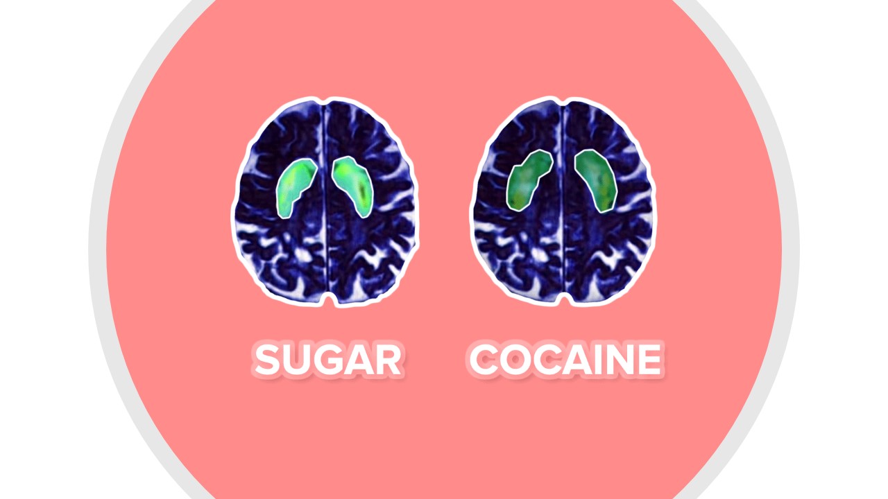 The brain on sugar and cocaine